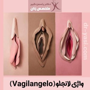 واژی لانجلو