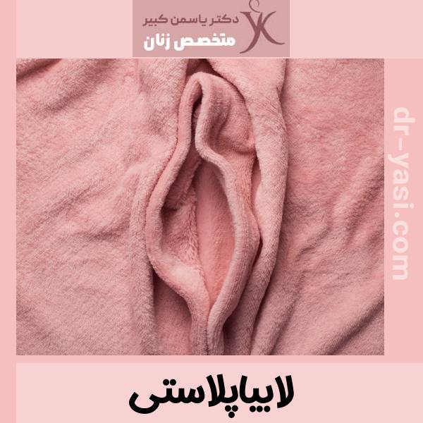 عکس لابیاپلاستی